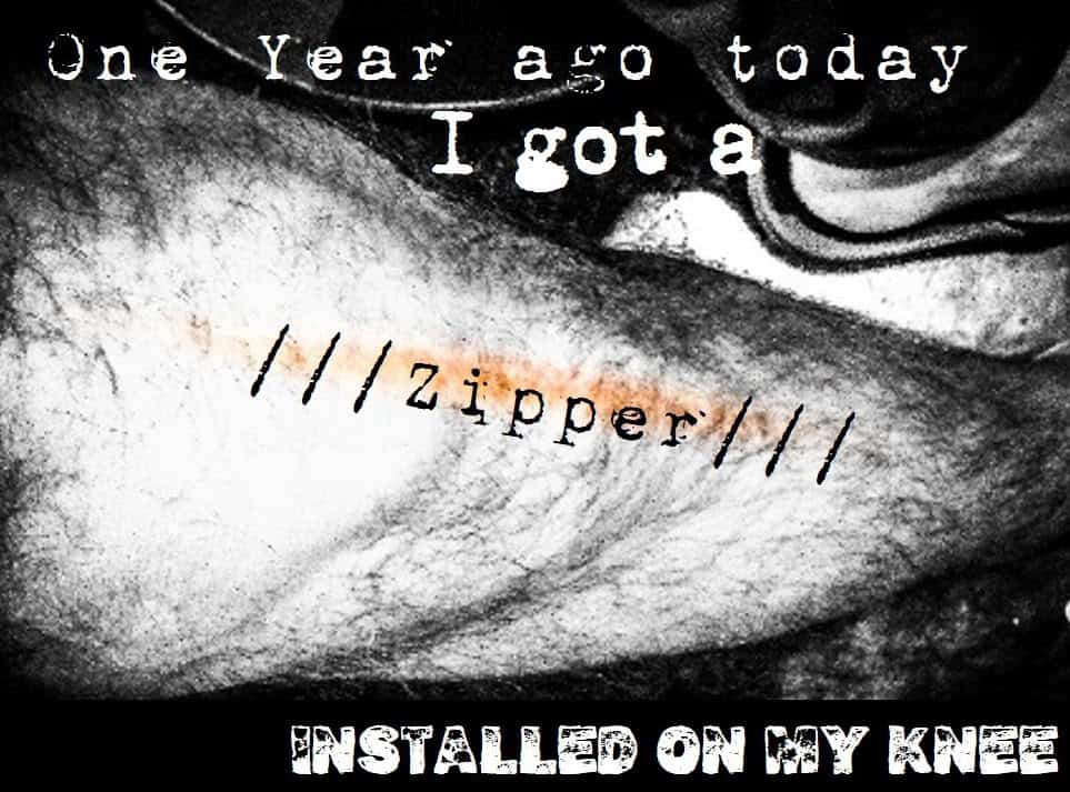 A year after having my knee sawed apart